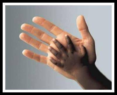 le racisme